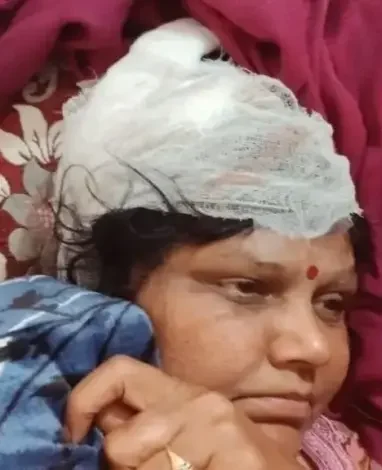 देहरादून में आवारा कुत्तों का आतंक, महिला पर हमला, नगर निगम से सख्त कार्रवाई की मांग